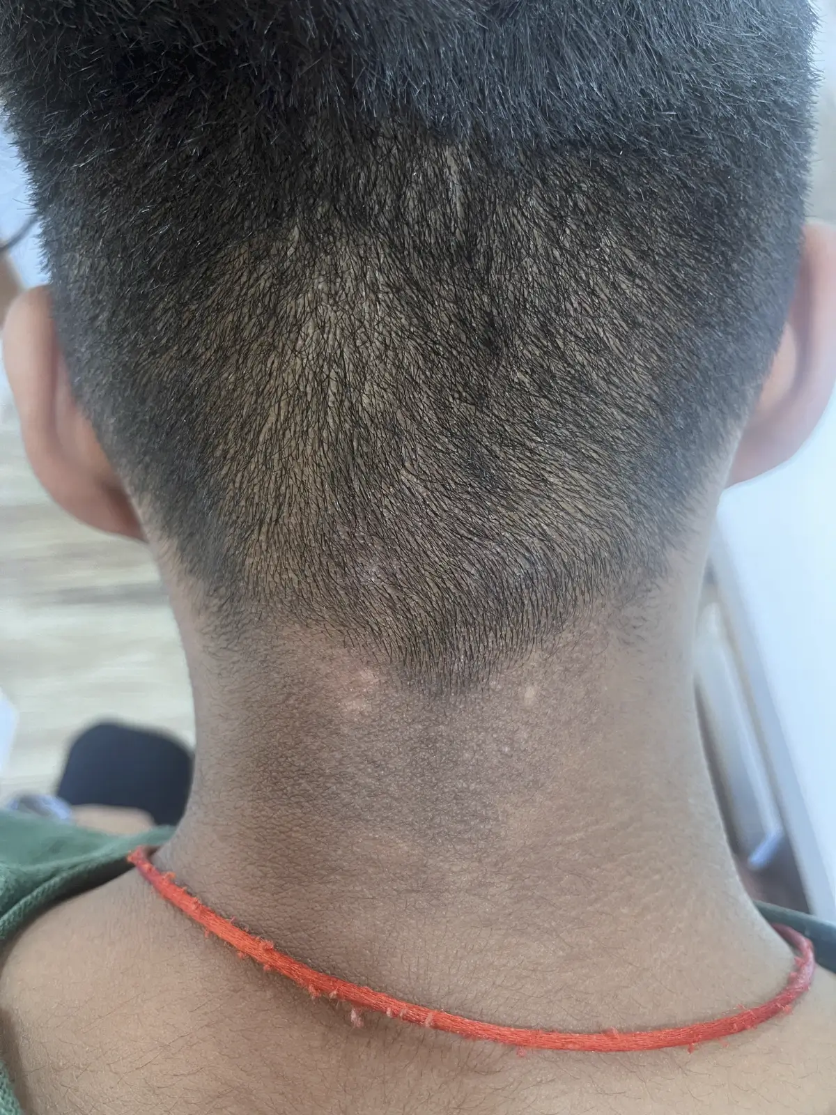 Other condition case 1 after treatment