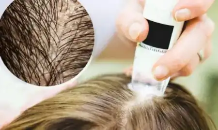 Ayurvedic Hair and Scalp Diagnostics